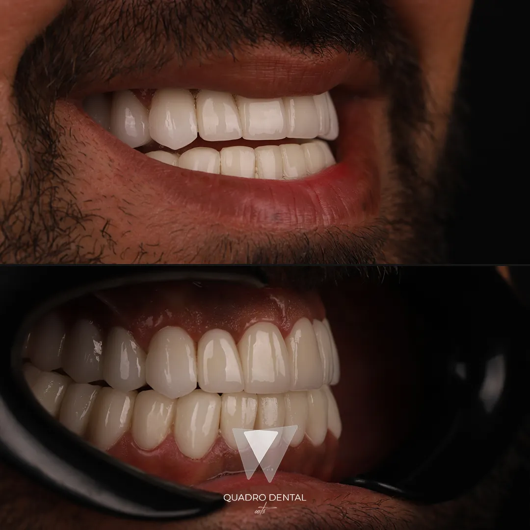 Quadro Dental Patient nach erfolgreicher Zahnbehandlung